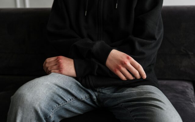 Gewalt­ver­dacht gegen Ehe­mann